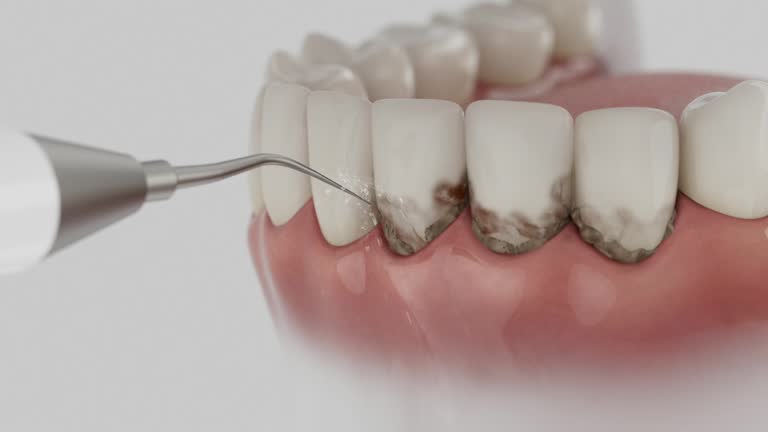 Trusted Dental Crowns And Bridges service in Giddings, TX - Dentist Open Now